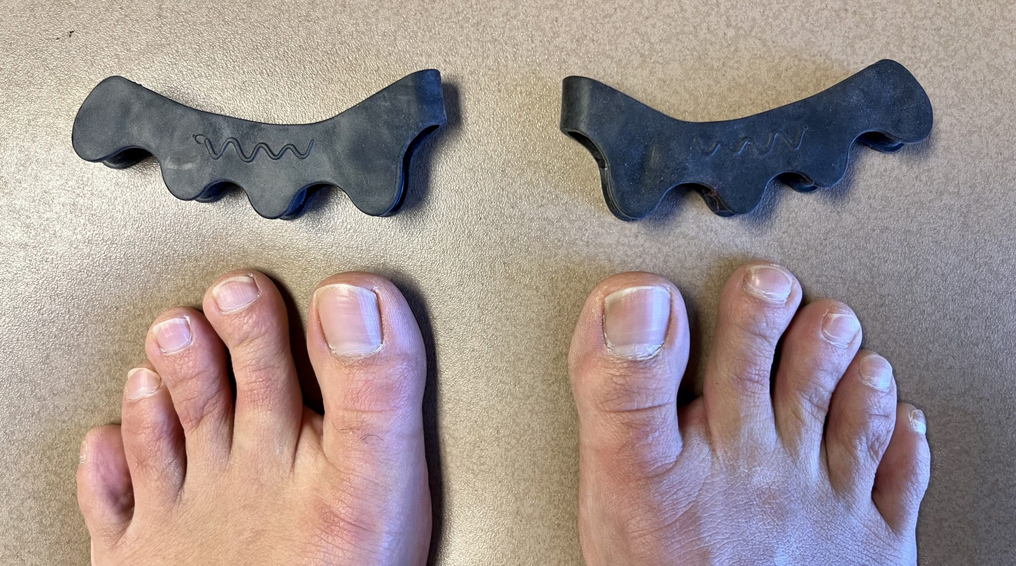 the-toe-spacer-review-do-toe-spacers-work