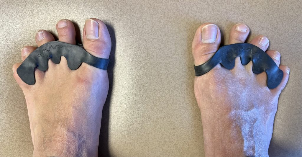 are toe separators good